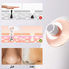 Deep pore cleaning device