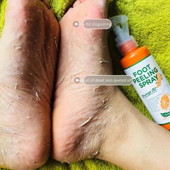 Japanese foot exfoliating spray